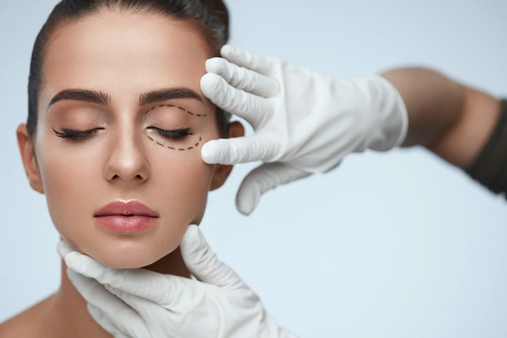 Blepharoplasty – Eyelid Surgery — hero image